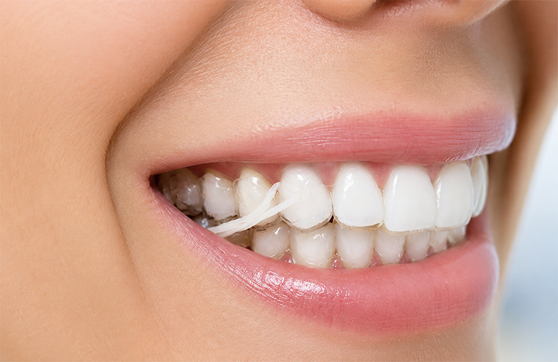 invisalign no itaim bibi