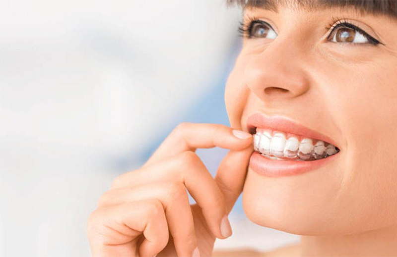 invisalign tratamento