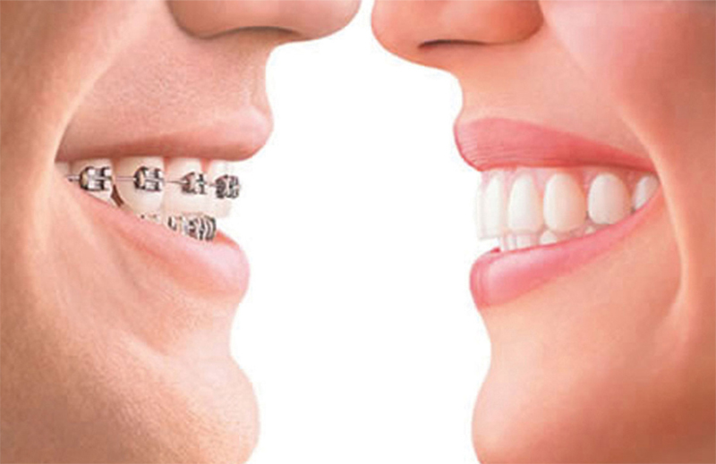 harmonia facial primeira consulta