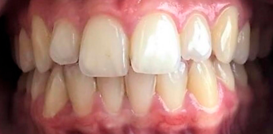 harmonia facial tratamento odontologico