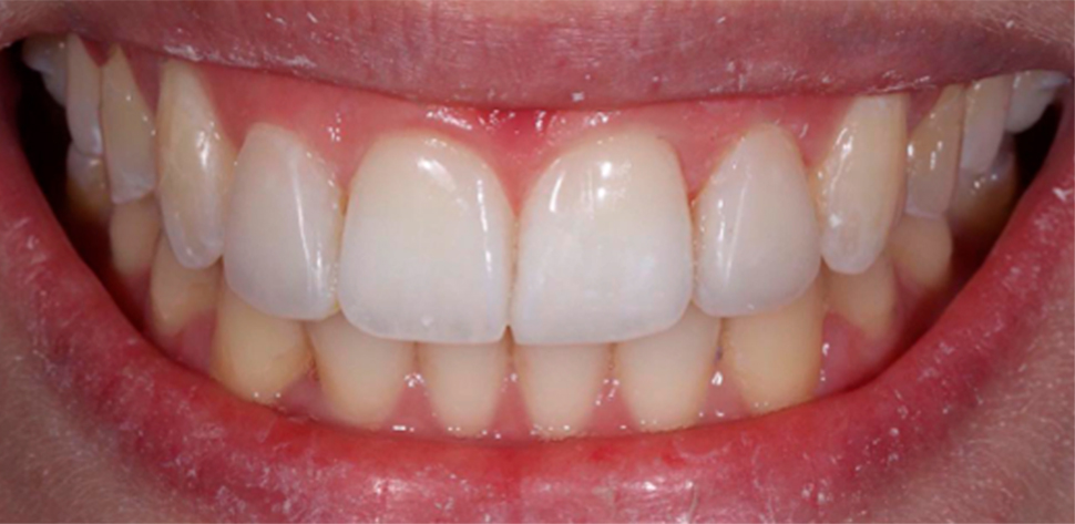 harmonia facial tratamento odontologico