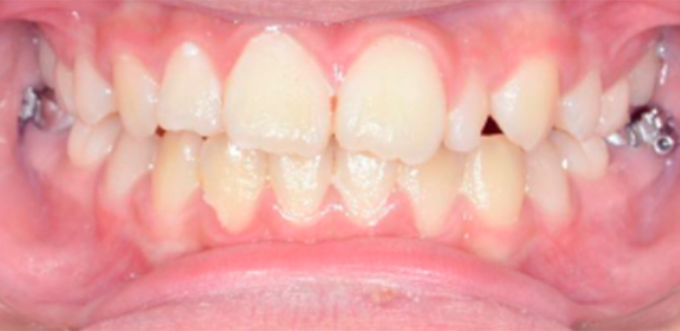 harmonia facial tratamento odontologico