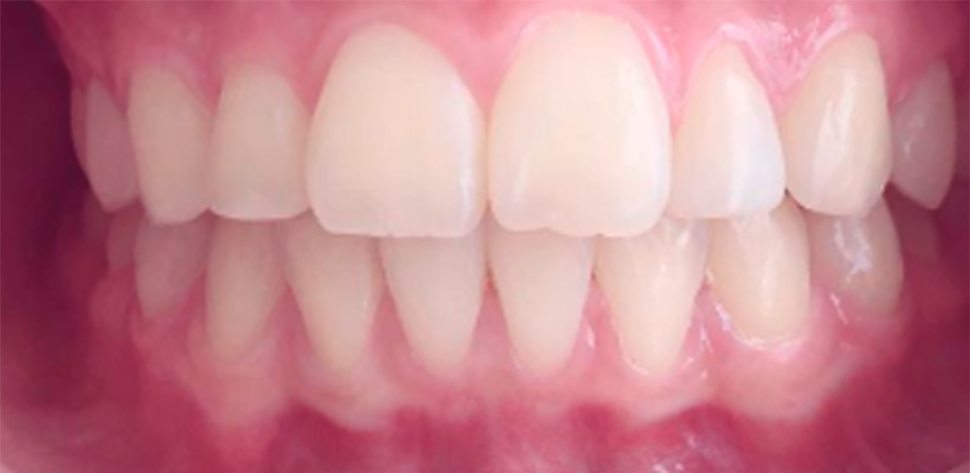 harmonia facial tratamento odontologico