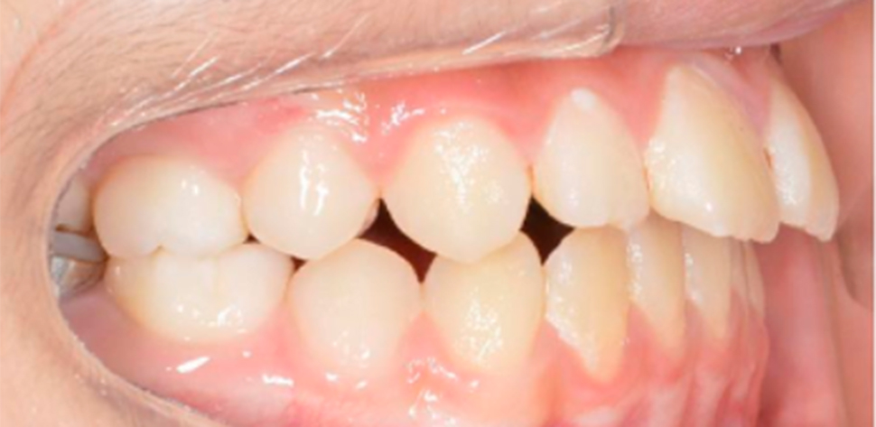 harmonia facial tratamento odontologico