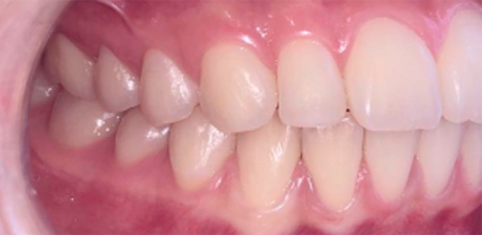 harmonia facial tratamento odontologico