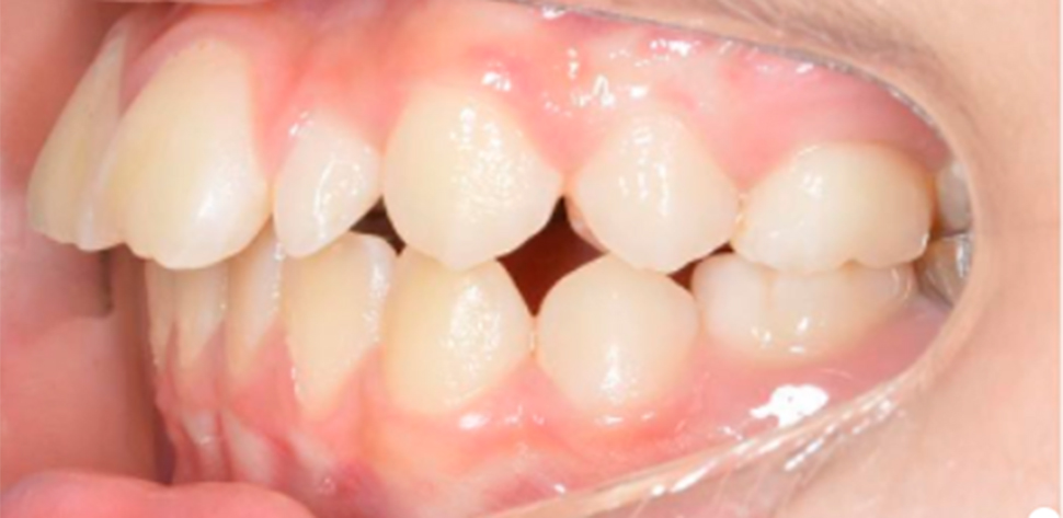 harmonia facial tratamento odontologico