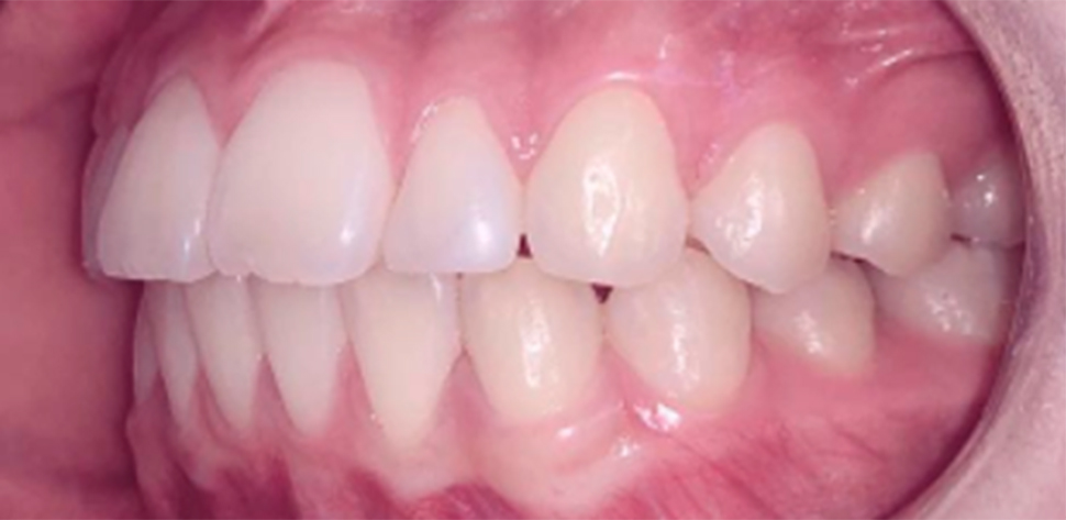 harmonia facial tratamento odontologico