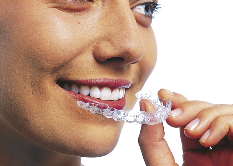 Invisalign – Clips Odontologia